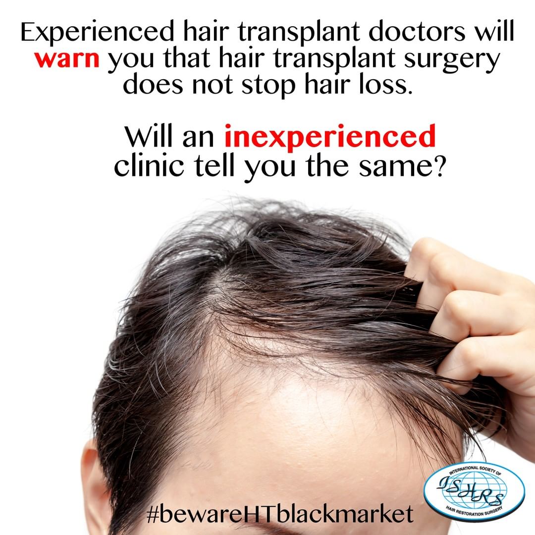 Experienced hair res