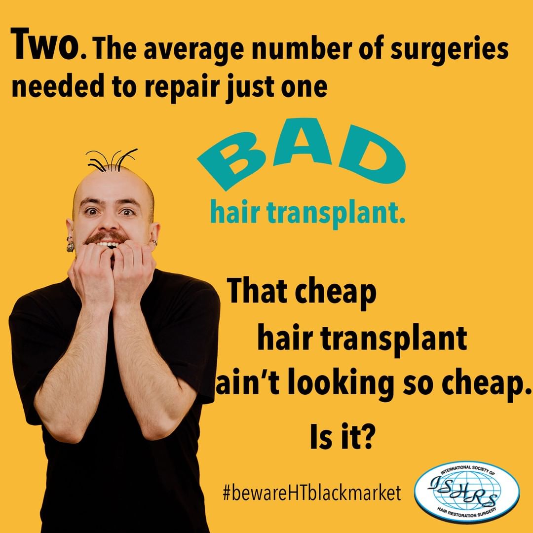 Most hair transplan