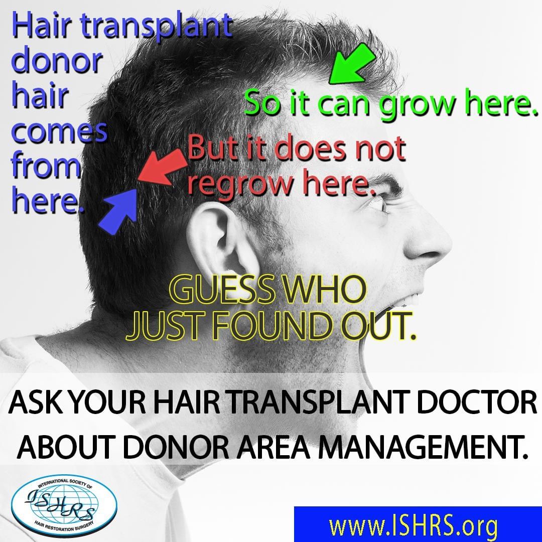 Hair transplant surg