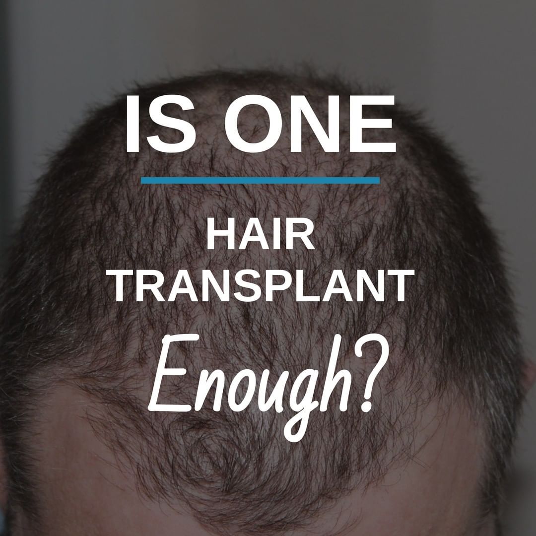 Hair transplant surg