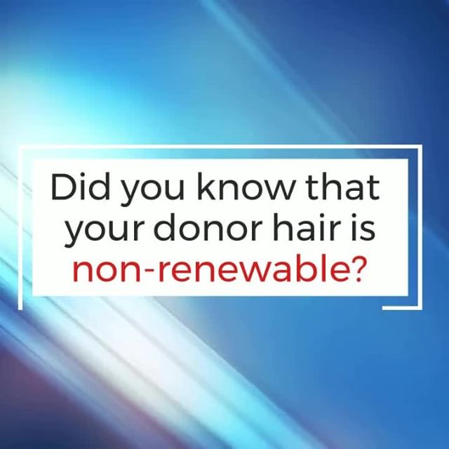 Hair transplantation