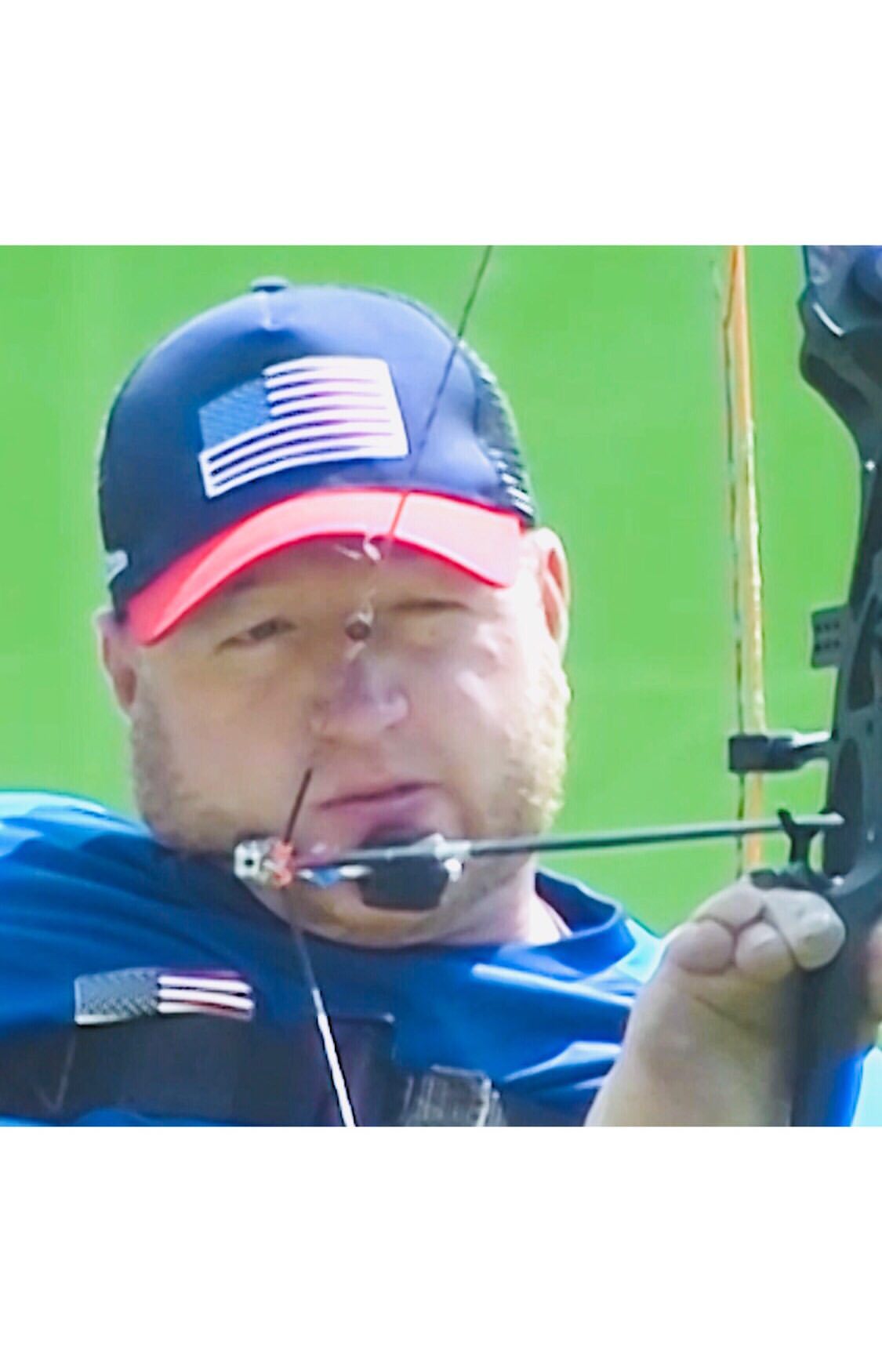  Matt Stutzman i