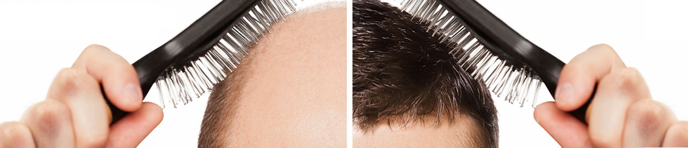 ISHRS World Congress banner ilikevents